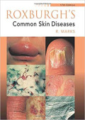 Roxburgh's Common Skin Diseases