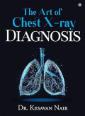 The Art of Chest X-ray Diagnosis