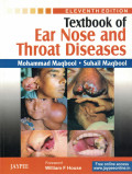 Textbook of Ear Nose and Throat Diseases