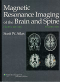 Magnetic Resonance Imaging of the Brain and Spine (2 Vol Set)