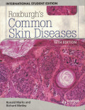 Roxburgh's Common Skin Diseases