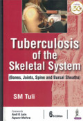 Tuberculosis of the Skeletal System