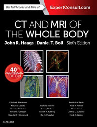 Image of CT and MRI of the Whole Body