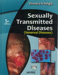 Image of Sexually Transmitted Diseases
