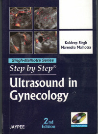 Image of Step by Step Ultrasound in Gynecology