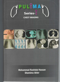 Image of PULIMA Series- Chest Imaging