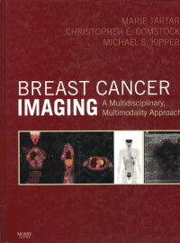 Image of Breast Cancer Imaging