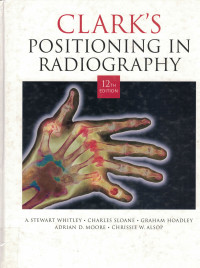Image of Clark's Positioning in Radiography