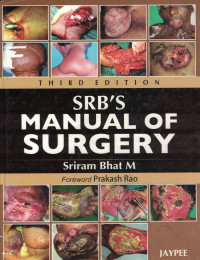 Image of SRB'S Manual of Surgery