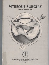 Image of Vitreous Surgery
